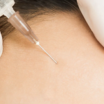 Same-Day Botox Treatments in North Bethesda MD